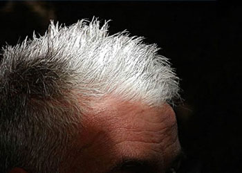 Beyaz saç mazide mi kalacak?