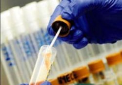 EHEC'de yeni baş şüpheli: Fasulye