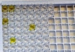 EHEC salgını Fransa'da ilk kurbanını aldı