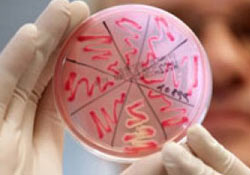 EHEC salgınında ölü sayısı 47 oldu