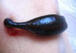 Sülükler şifa dağıtacak