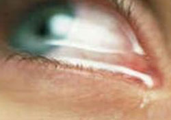 Kırmızı göz kâbusu dönebilir!