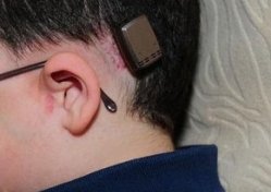 İşitme kaybında doğru cihazı seçmek çok önemli!