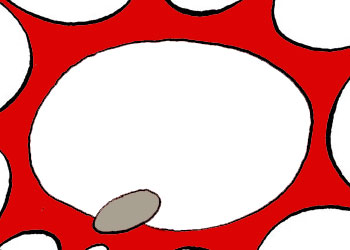 Aczin ve fakrın ilanı dua iledir -Karikatür