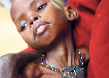 İnsani kriz değil, insani felaket söz konusu