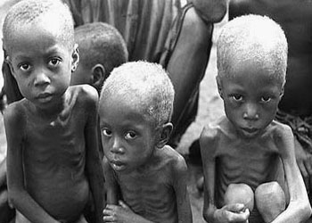 Afrika Boynuzu: Her gün 60 çocuk ölüyor
