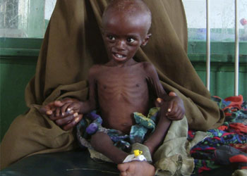 İslam dünyasi Somali için seferber oldu