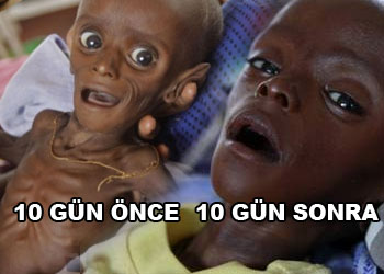 Açlığın sembolü Minhaj, hayata tutundu