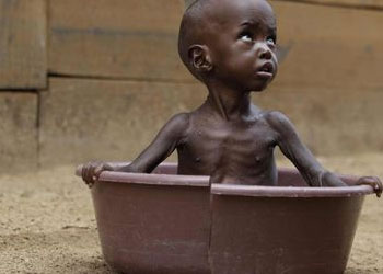 Çocuklar 4 yaşına gelmeden ölüyor