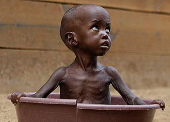 Somali'den daha fakiriz, çünkü ihtiyacımız çok