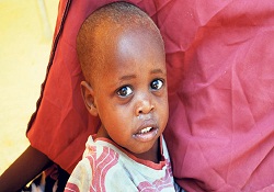 A vitamini 600 bin hayat kurtarır!