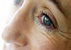 Yaşlanma göz çevresinde başlıyor