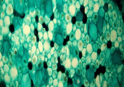 Sağlıklı bünye kanseri önlüyor