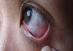 Görme siniri iltihabına dikkat!