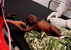 Türk doktorlar ameliyatlara başladı