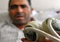Türkiye'nin ikinci 'kalpsiz' hastası