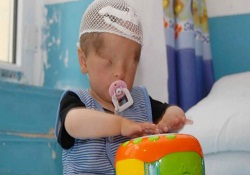 Doğuştan gözleri yok ama...