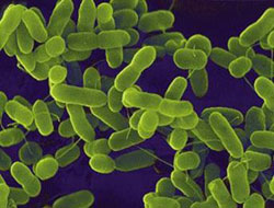 ABD ordusu yanlışlıkla canlı şarbon bakterisi göndermiş