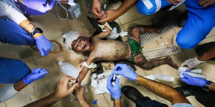 Gazze'de gönüllü çalışan doktor ve hemşireler şahit oldukları dehşeti New York Times'a anlattı