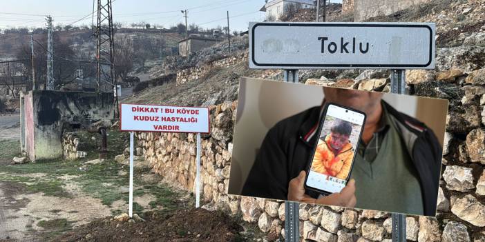 Belediyeler ve köpek lobileri masumların kanına giriyor: Çocuğa saldıran hayvan kuduz çıktı!