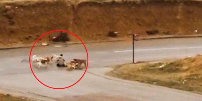 Yine Ankara, yine köpek terörü: Defalarca ısırılan adam ölümden döndü
