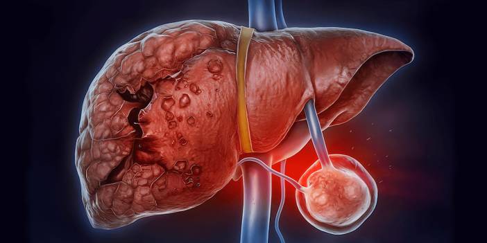 Köpeklerin yaydığı 'kist hidatik' ölümle sonuçlanıyor