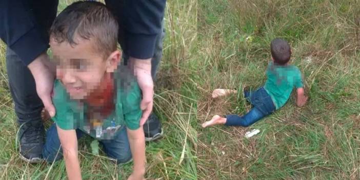 Yalova'da bakkala giderken köpeklerin saldırdığı çocuk ağır yaralandı