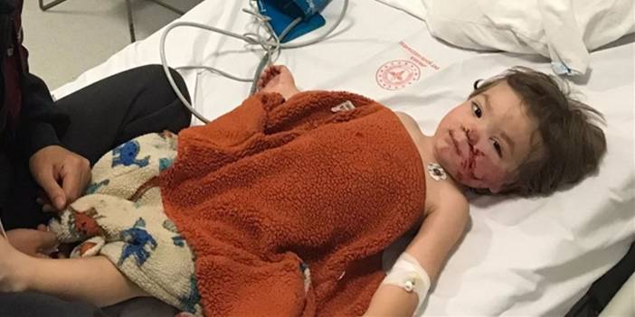 Köpek terörü Ankara'da: 1,5 ve 5 yaşındaki iki kardeş hastaneye kaldırıldı